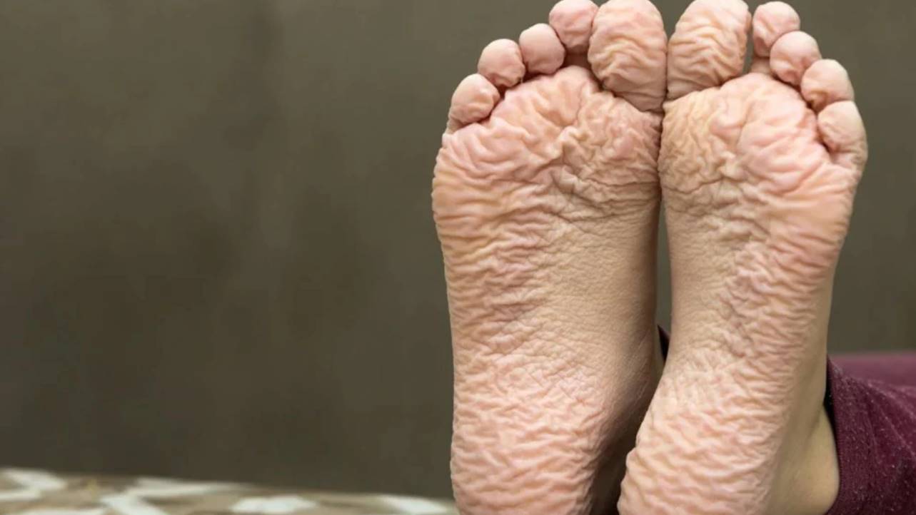 Victoria size wrinkled soles free porn photo