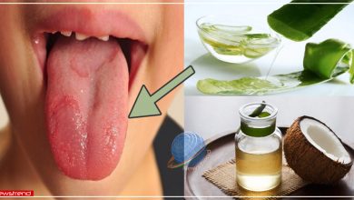 tongue ulcer home remedy