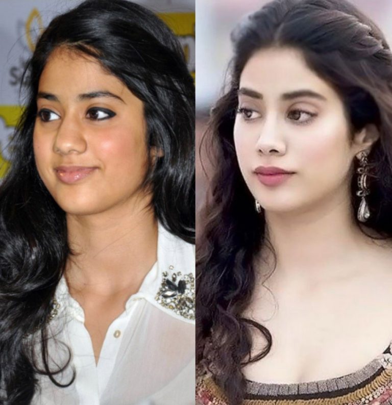 Jhanvi Kapoor Nose Surgery Newstrend