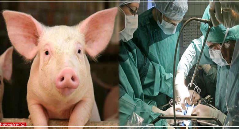 doctors-succeeded-in-transplanting-pig-kidney-to-human