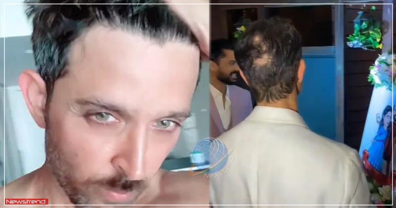 Salman और Akshay क जस Hrithik भ गज नकल  Hrithik Roshan Forget To  Wear His Hair Patch  YouTube